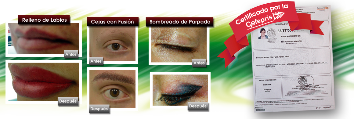 basico
